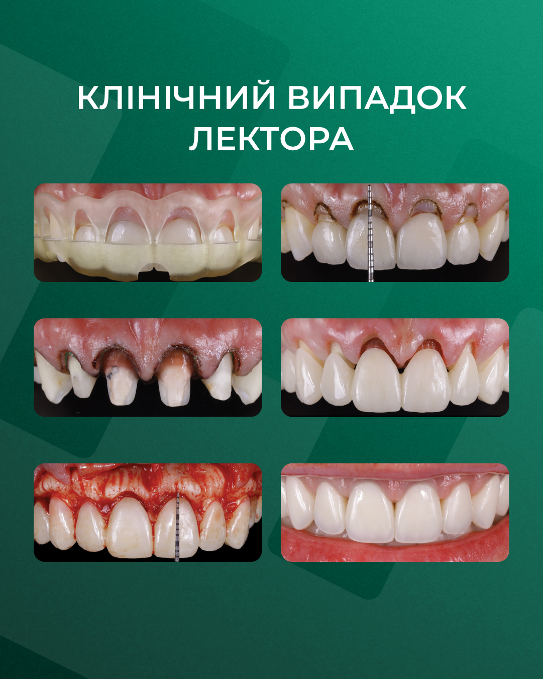 Тренінг №5